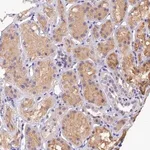 Merck Anti-DGKH antibody produced in rabbit