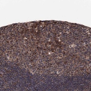 Merck Anti-CDC23 antibody produced in rabbit