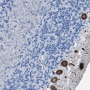 Merck Anti-RAB3IL1 antibody produced in rabbit