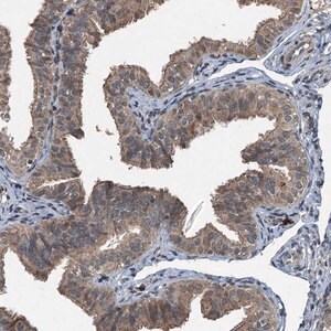 Merck Anti-TCTN1 antibody produced in rabbit