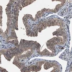 Merck Anti-TCTN1 antibody produced in rabbit