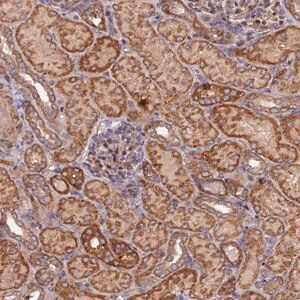 Merck Anti-FERMT1 antibody produced in rabbit