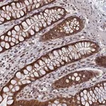 Merck Anti-PIGQ antibody produced in rabbit