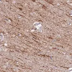 Merck Anti-NEDD4 antibody produced in rabbit