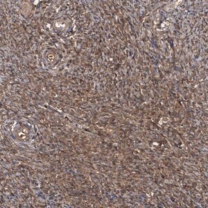 Merck Anti-HYI antibody produced in rabbit