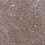 Merck Anti-HYI antibody produced in rabbit