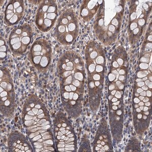 Merck Anti-TMEM39B antibody produced in rabbit