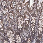 Merck Anti-TMEM39B antibody produced in rabbit