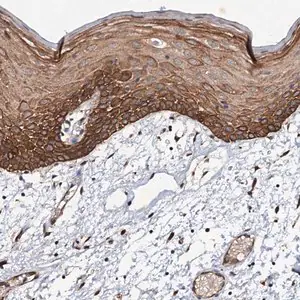 Merck Anti-ADAMTS10 antibody produced in rabbit