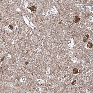 Merck Anti-WHAMM antibody produced in rabbit