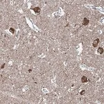 Merck Anti-WHAMM antibody produced in rabbit