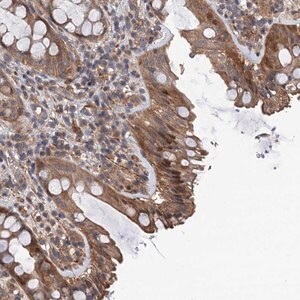 Merck Anti-TMEM39B antibody produced in rabbit