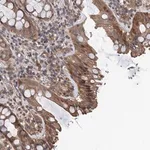 Merck Anti-TMEM39B antibody produced in rabbit
