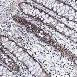 Merck Anti-GADL1 antibody produced in rabbit