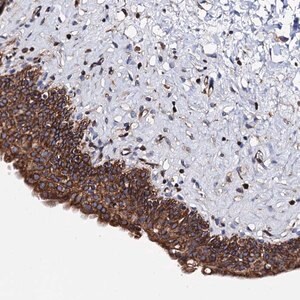 Merck Anti-ZDHHC18 antibody produced in rabbit