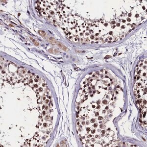 Merck Anti-C11orf49 antibody produced in rabbit