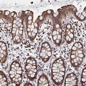 Merck Anti-PIGN antibody produced in rabbit