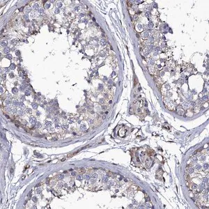 Merck Anti-TTC23 antibody produced in rabbit