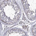 Merck Anti-TTC23 antibody produced in rabbit