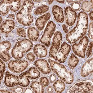 Merck Anti-DGKH antibody produced in rabbit