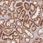 Merck Anti-DGKH antibody produced in rabbit