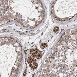 Merck Anti-CNNM1 antibody produced in rabbit