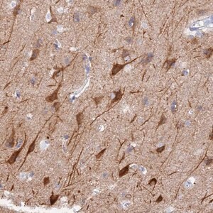 Merck Anti-VPS33B antibody produced in rabbit