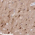 Merck Anti-VPS33B antibody produced in rabbit