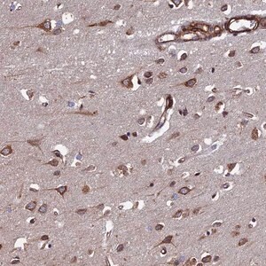 Merck Anti-CTDP1 antibody produced in rabbit