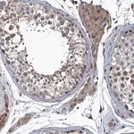 Merck Anti-MDM1 antibody produced in rabbit