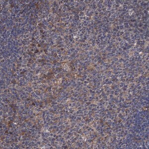 Merck Anti-ARHGAP11A antibody produced in rabbit