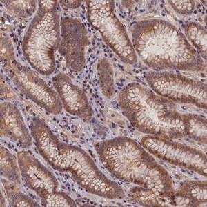 Merck Anti-C15orf52 antibody produced in rabbit