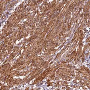 Merck Anti-CCDC102B antibody produced in rabbit