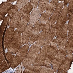 Merck Anti-RAD9B antibody produced in rabbit