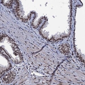 Merck Anti-ZMIZ2 antibody produced in rabbit