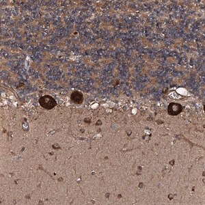 Merck Anti-FLYWCH1 antibody produced in rabbit