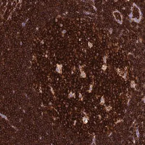 Merck Anti-ADAT1 antibody produced in rabbit