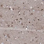 Merck Anti-GFOD2 antibody produced in rabbit