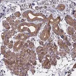 Merck Anti-ZCCHC2 antibody produced in rabbit