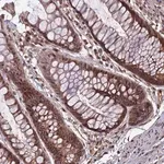 Merck Anti-SPG11 antibody produced in rabbit