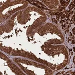 Merck Anti-CCDC102A antibody produced in rabbit