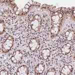 Merck Anti-CDYL2 antibody produced in rabbit