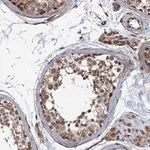 Merck Anti-FSIP1 antibody produced in rabbit