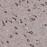 Merck Anti-SLC25A38 antibody produced in rabbit