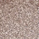 Merck Anti-AGRP antibody produced in rabbit