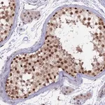 Merck Anti-RFC5 antibody produced in rabbit