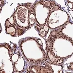Merck Anti-N4BP1 antibody produced in rabbit