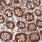 Merck Anti-MACROD1 antibody produced in rabbit