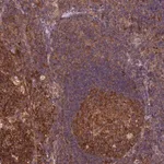 Merck Anti-TRMT1 antibody produced in rabbit