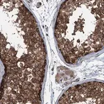 Merck Anti-TRAPPC8 antibody produced in rabbit